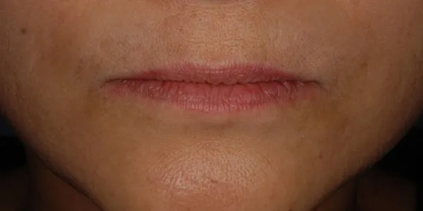 前方・口元(閉)